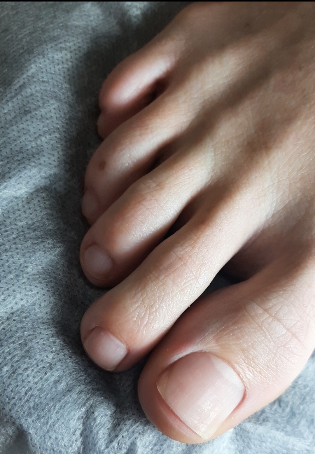 Neatly shaped natural toenails